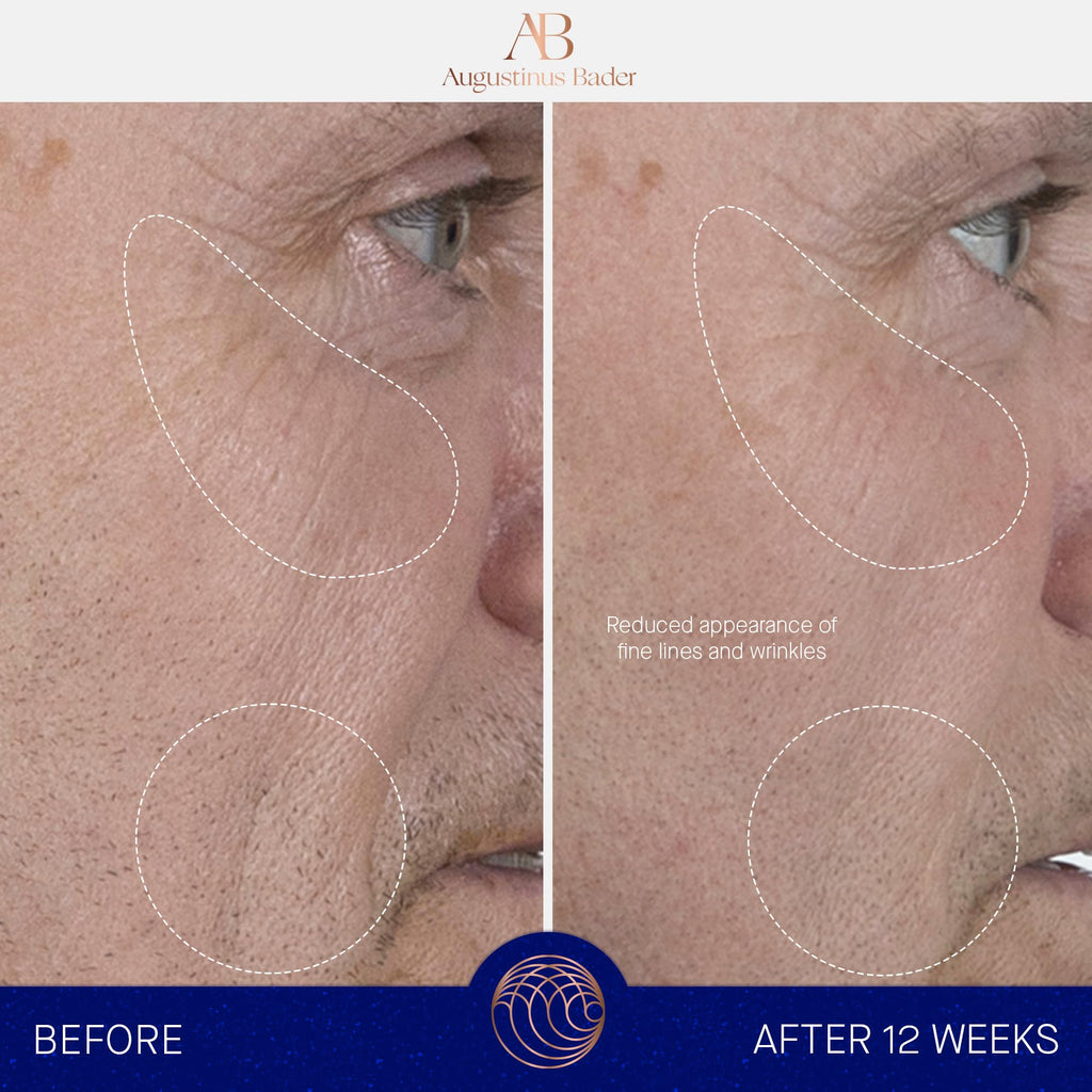 Augustinus Bader The Serum – Hydrating Anti-Aging Serum for Firmer, Smoother Skin (15 ml)