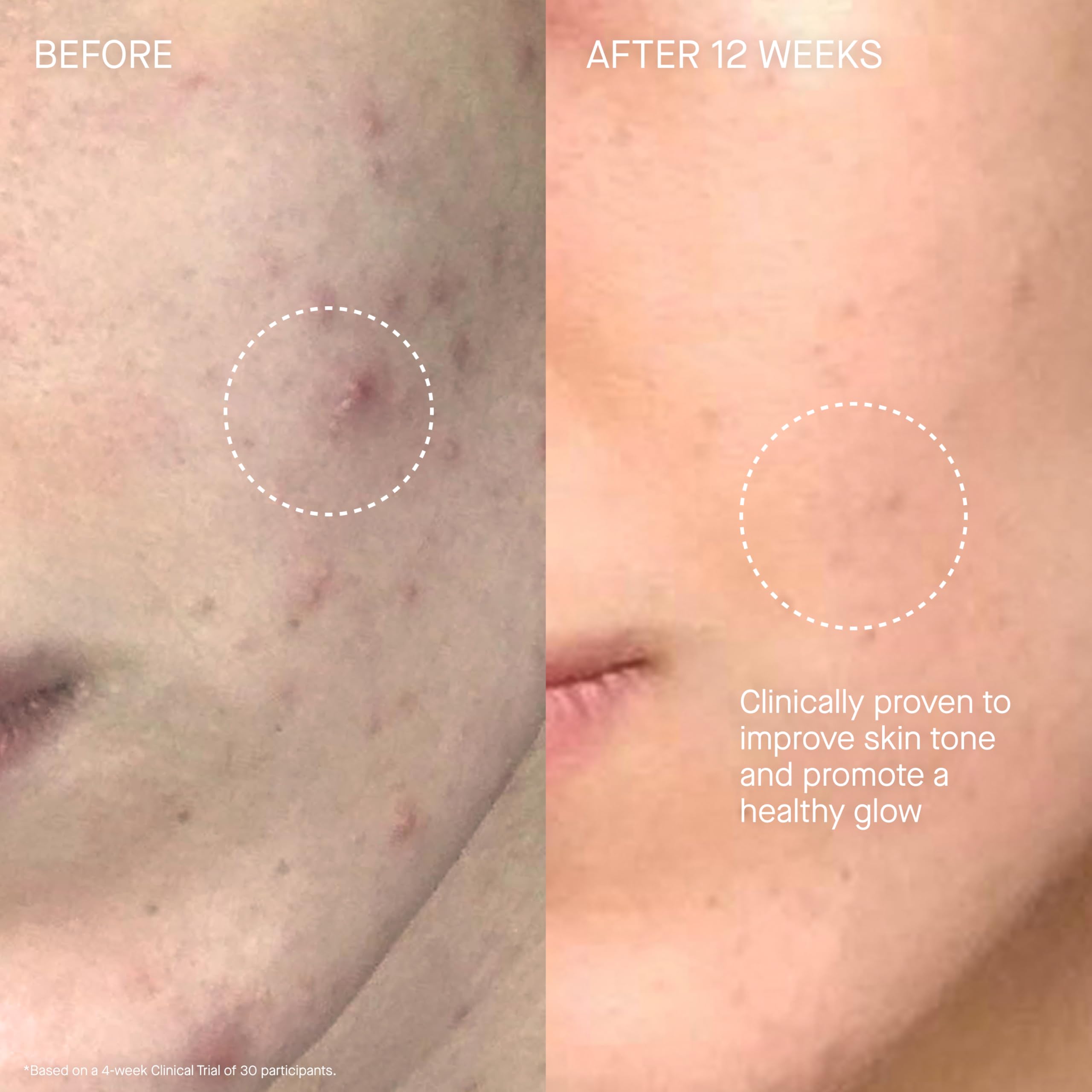 Augustinus Bader The Cream – Luxury Hydrating Face Moisturizer | TFC8®
