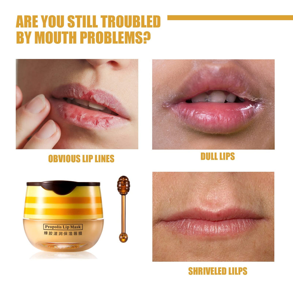 Axnzp 4 Pcs Honey Lip Balm Pot — Moisturizing Lip Mask to Soften Lips & Prevent Dryness