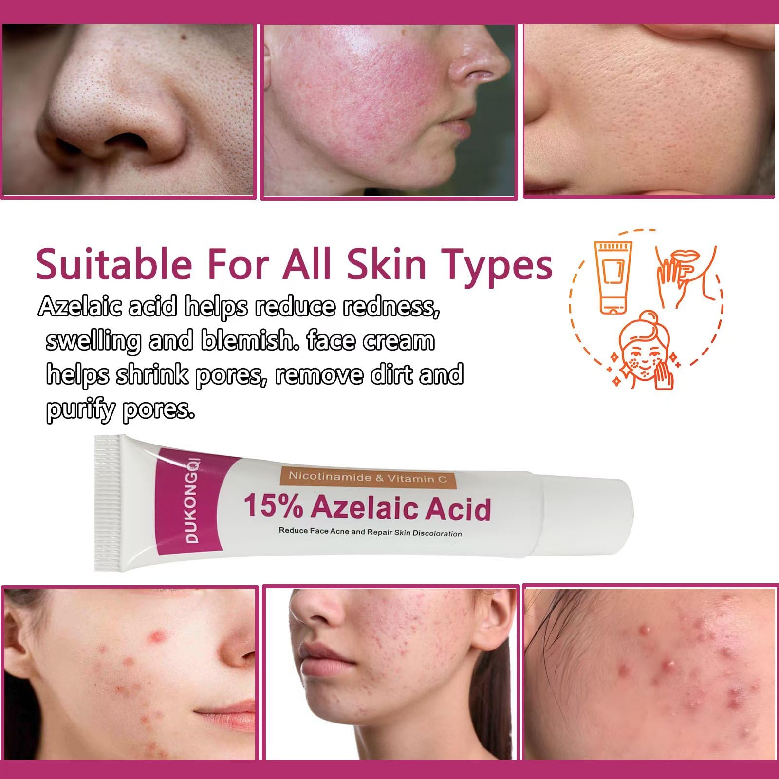 Azelaic Acid Serum 12% for Balanced Skin Tone & Purified Pores, 20g