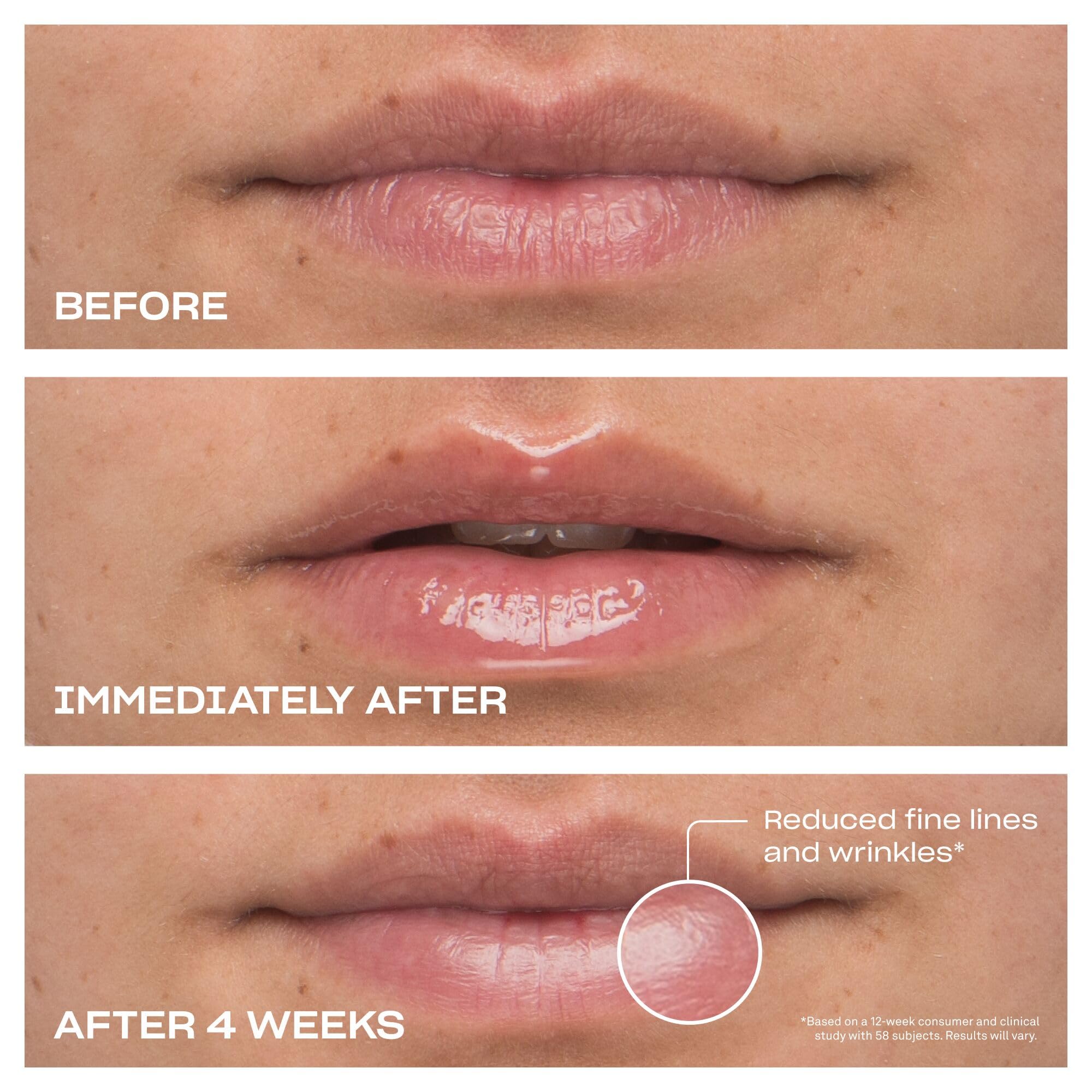 BABE ORIGINAL Cloud 9 Lip Serum | Hydrating Lip Treatment with Cloudberry Oil, Peptides & Hyaluronic Acid