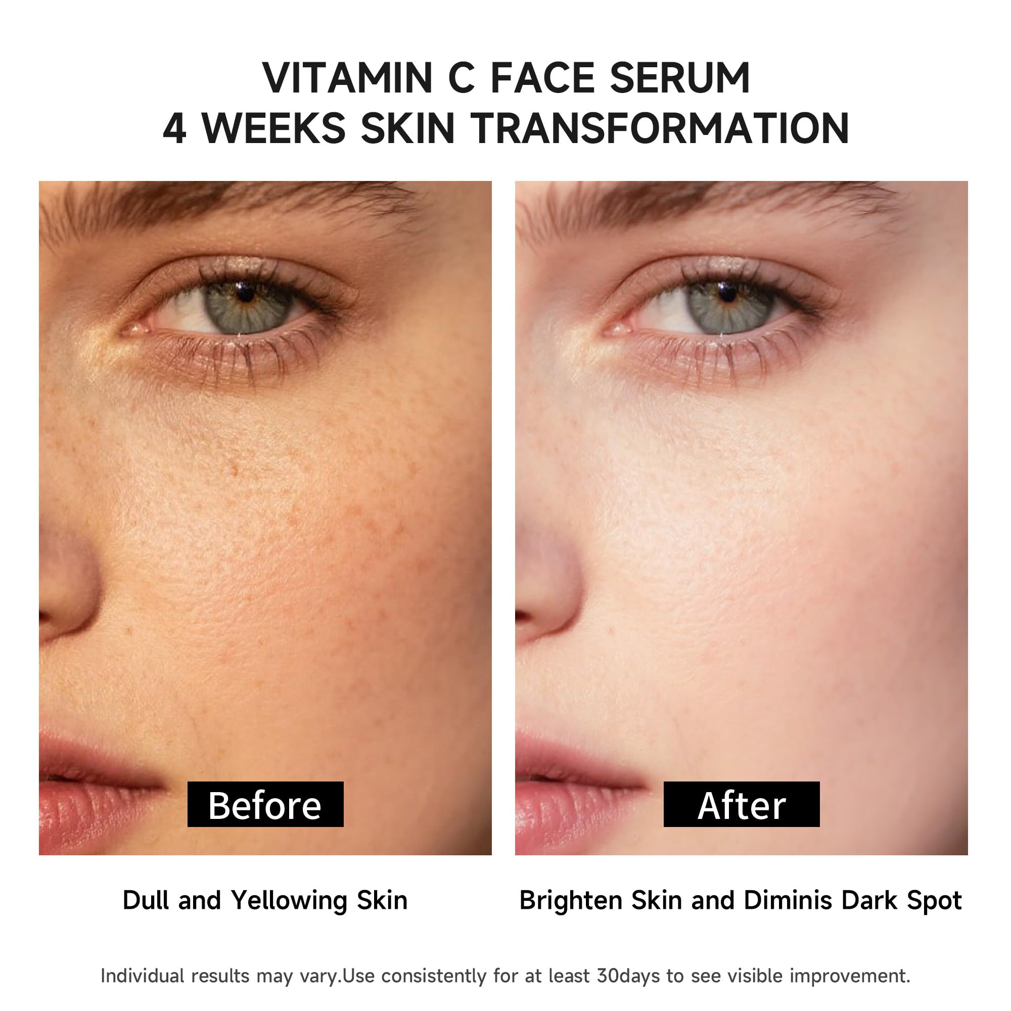 BACHERI Vitamin C Serum with Glutathione, 4D Hyaluronic Acid & Aloe – Lightweight Brightening & Hydrating Ampoules, 30 x 1.0 mL