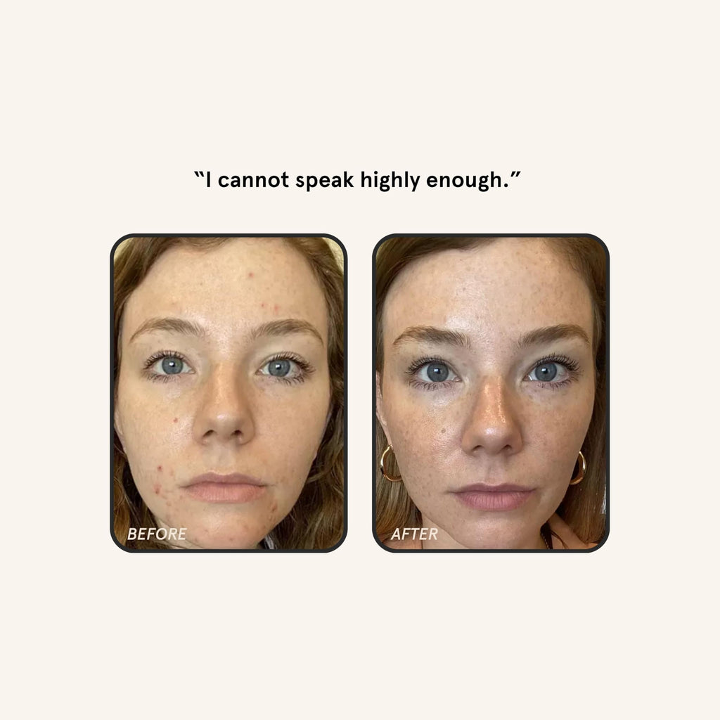 Barefaced Retinal Skin Therapy 30ml – Retinaldehyde & Bakuchiol Serum for Firming, Smoothing & Even Tone