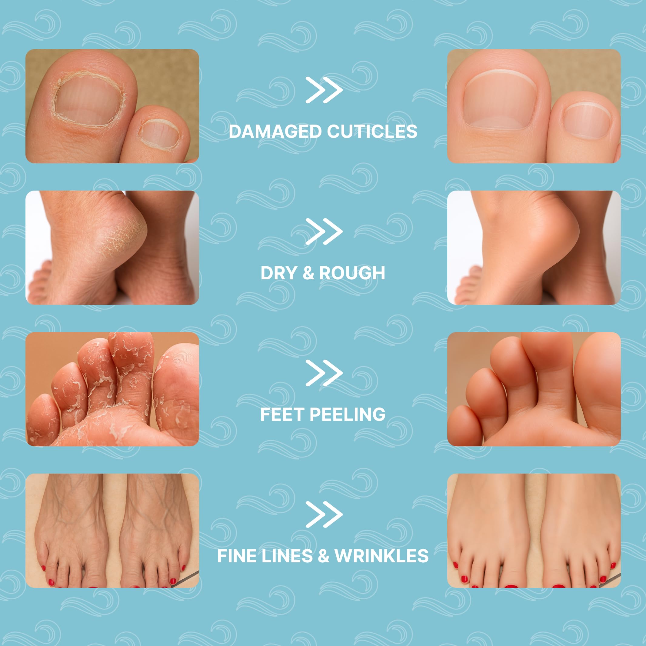 Foot Mask Moisturizing Socks for Dry Cracked Feet | Bayside Hydrates with Snail Mucin, Shea Butter & Hyaluronic Acid