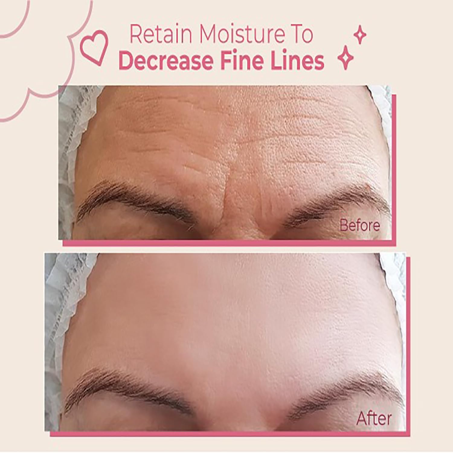 Bayside Forehead Wrinkle Patches - Reusable Non-Invasive Skin Care, 2-Pack