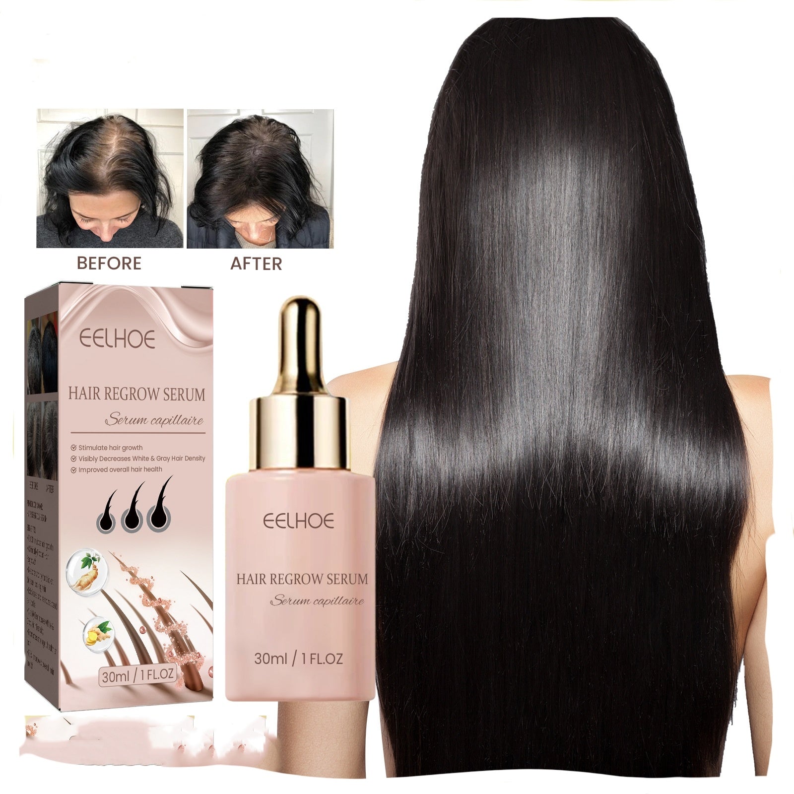 EELHOE Hair Growth Serum - Anti Hair Loss Treatment with Natural Botanicals | 30ml