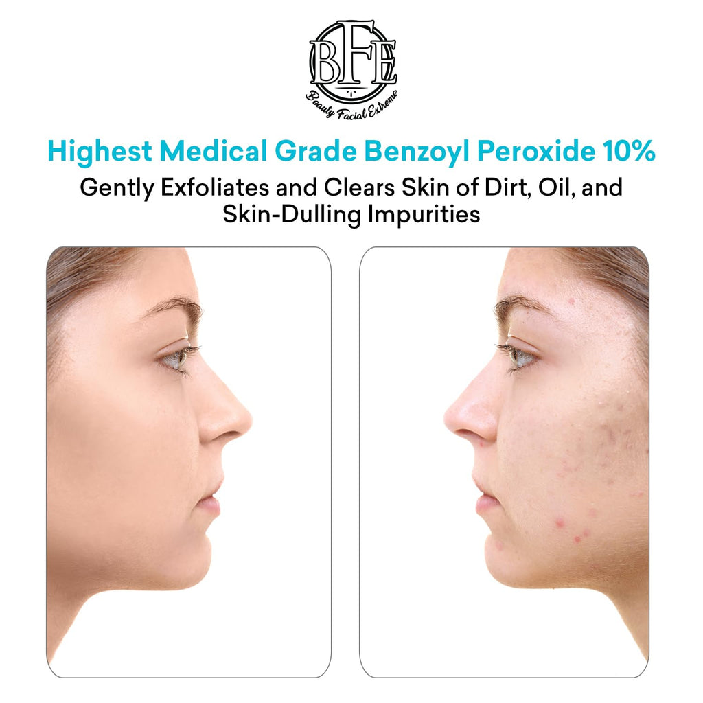 Beauty Facial Extreme Acne Face Wash 10% Benzoyl Peroxide – Deep Cleansing for Oily Skin & Breakouts