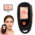 Beauty Star Dermatoscope 500x – Handheld Skin & Scalp Microscope, 8 LED, 1080P Display