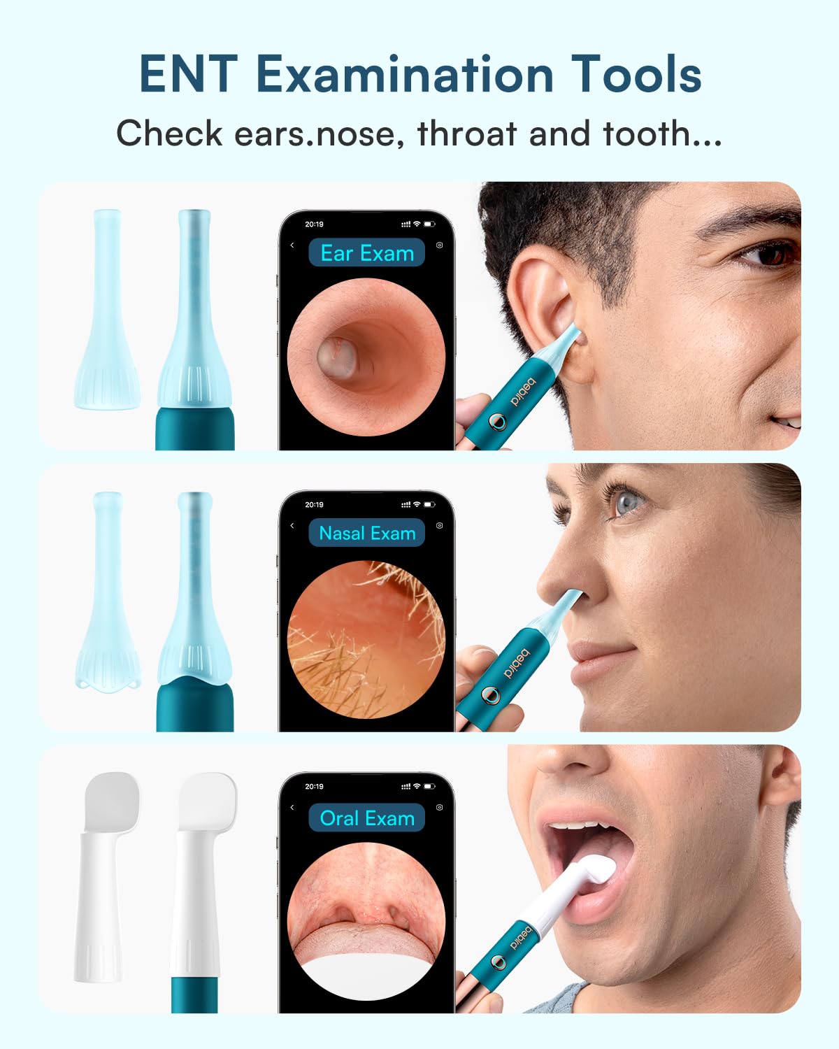 BEBIRD Earsight Ultra Ear Wax Removal Kit with 2K HD Camera | 90-Min Battery, Visual Ear Cleaner