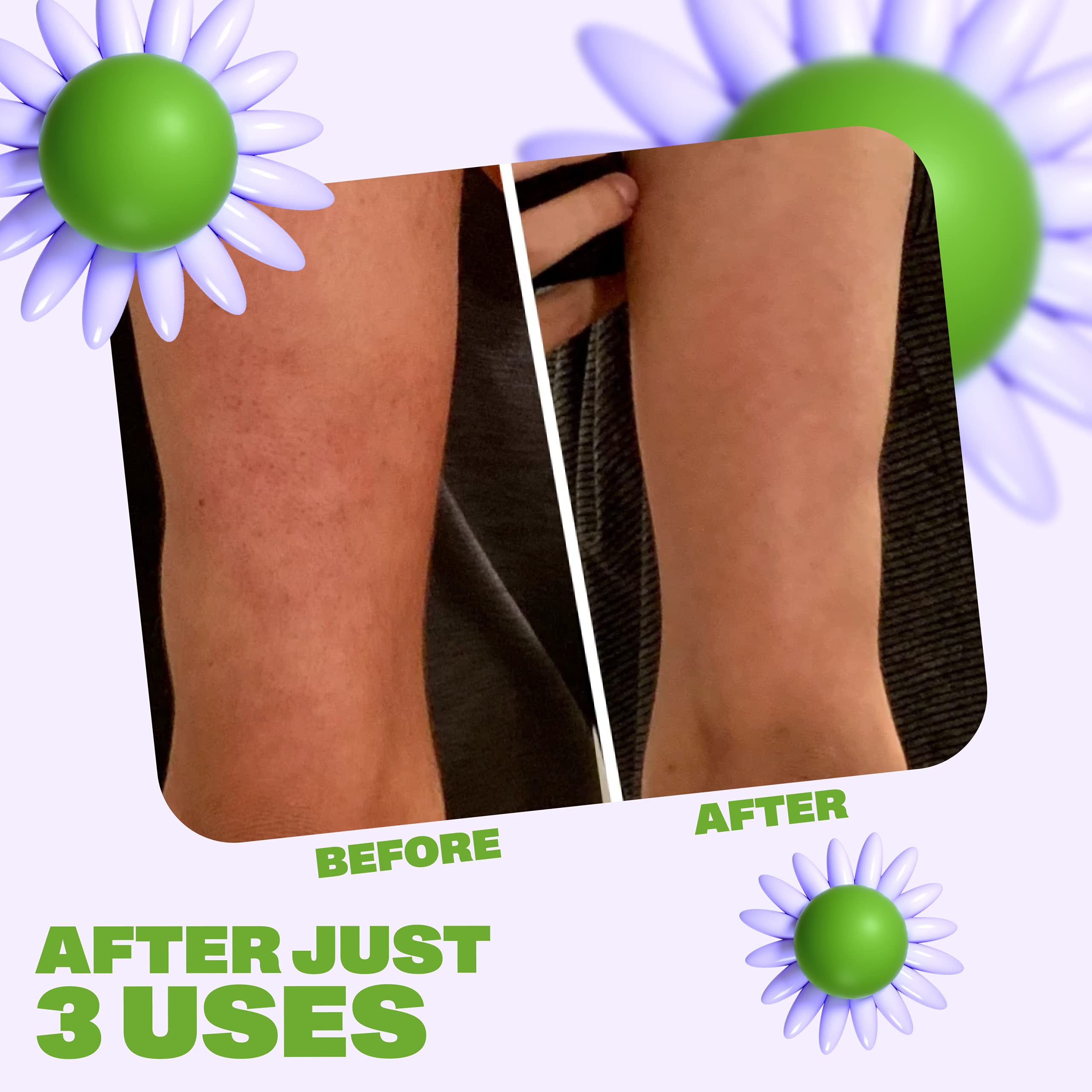 Becky Natural Walnut Scrub + Exfoliator | Smooth Skin, May Help Bumps & Stretch Marks