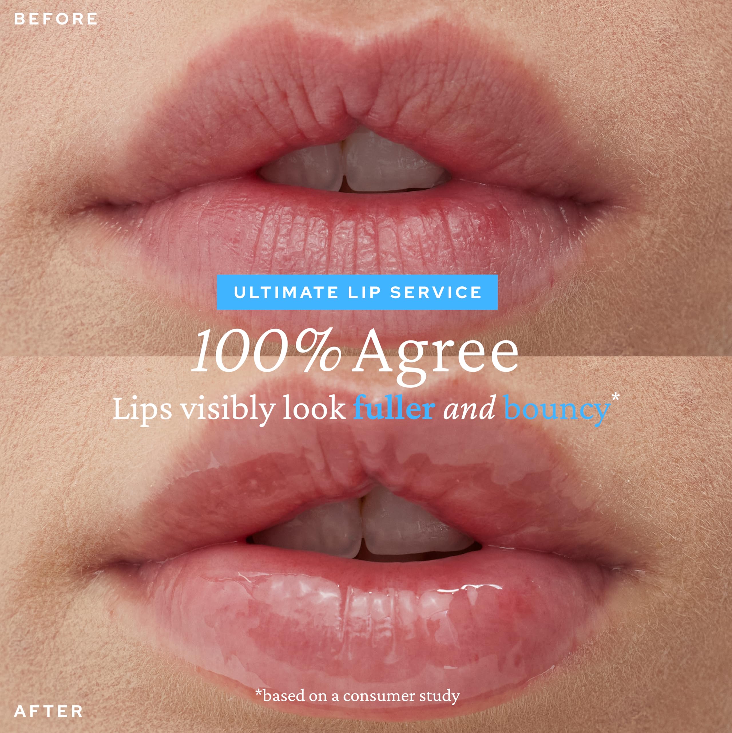 Belif Super Knights Lipcerin Lip Balm | Hyaluronic Acid & Vitamin C | Hydration & Plumping