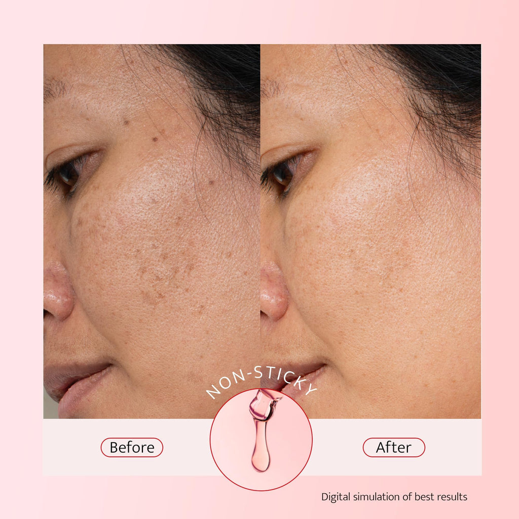 Bestkiss 10% Niacinamide + 5% Tranexamic Acid + 2% Alpha-Arbutin Dark Spot Serum | Ceramides & HA