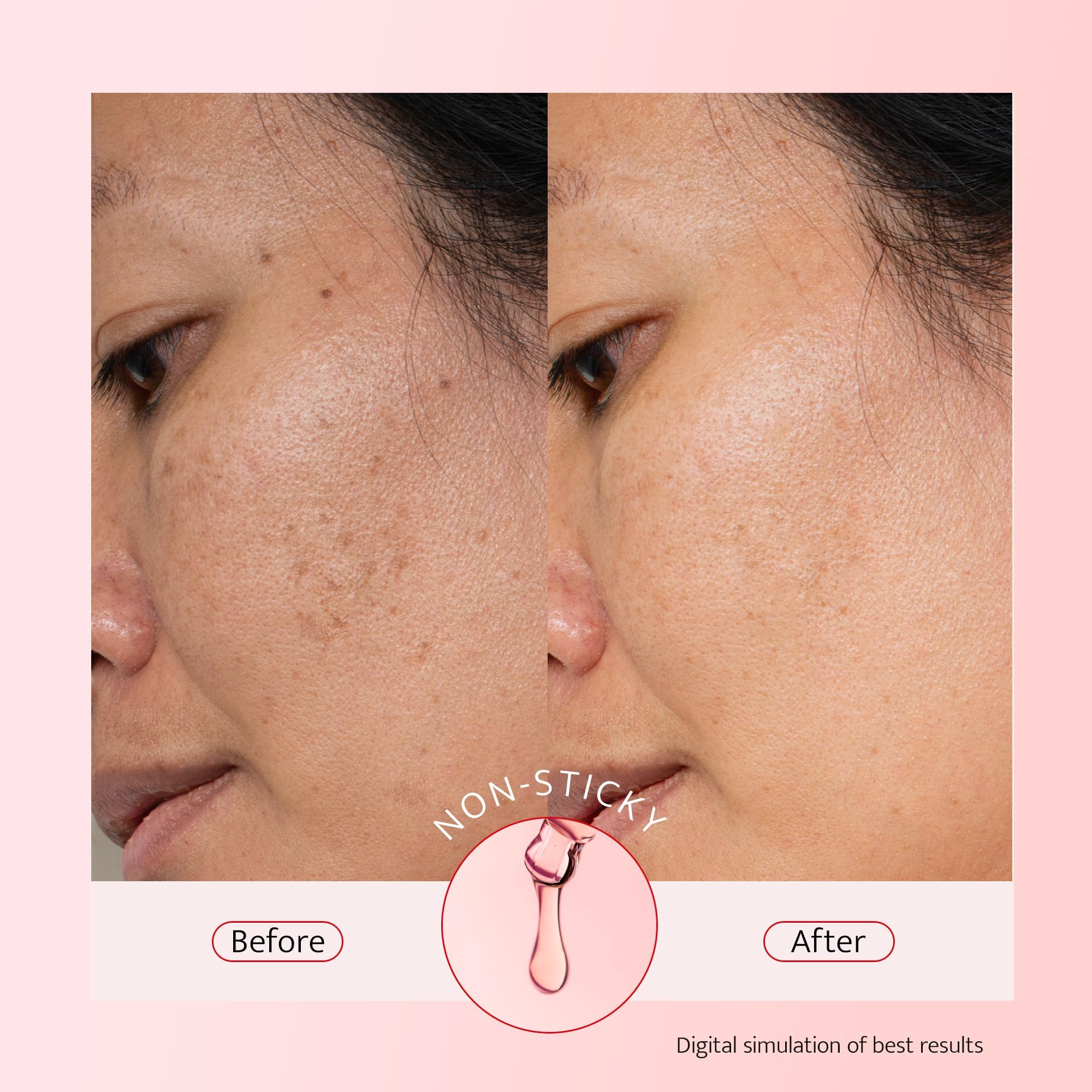 Bestkiss 10% Niacinamide + 5% Tranexamic Acid + 2% Alpha-Arbutin Dark Spot Serum | Ceramides & HA