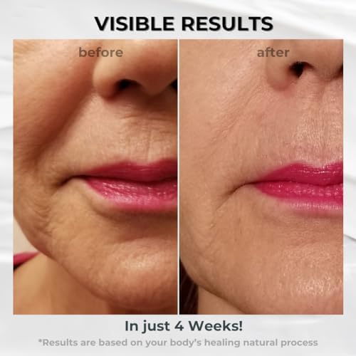 BIONOVA Nose-to-Mouth Wrinkle Treatment with UV Chromophores – Reduce Fine Lines & Lip Wrinkles (0.5 oz)