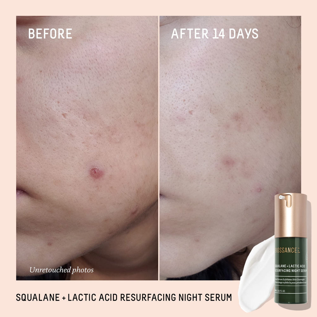 BIOSSANCE Rapid Radiance Set – Hydration, Radiance & Texture Refinement