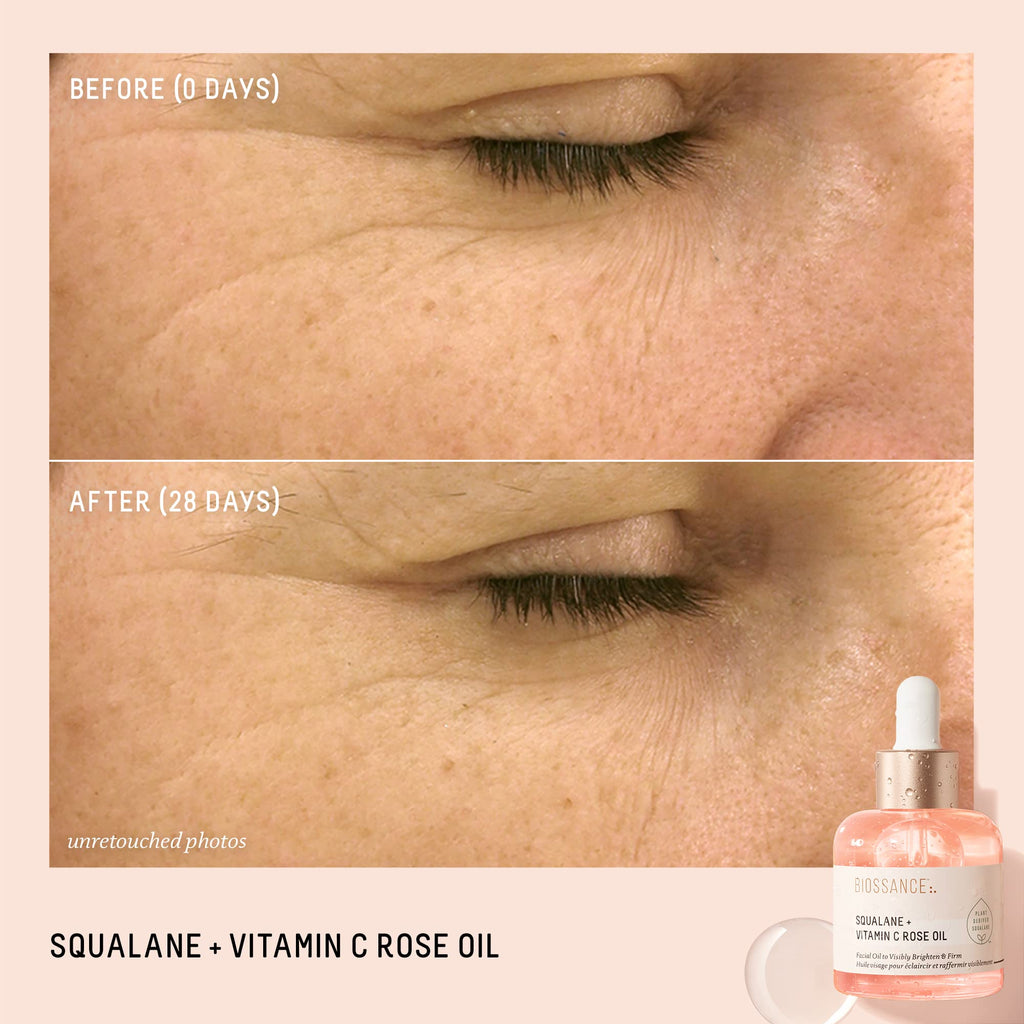 BIOSSANCE Rapid Radiance Set – Hydration, Radiance & Texture Refinement
