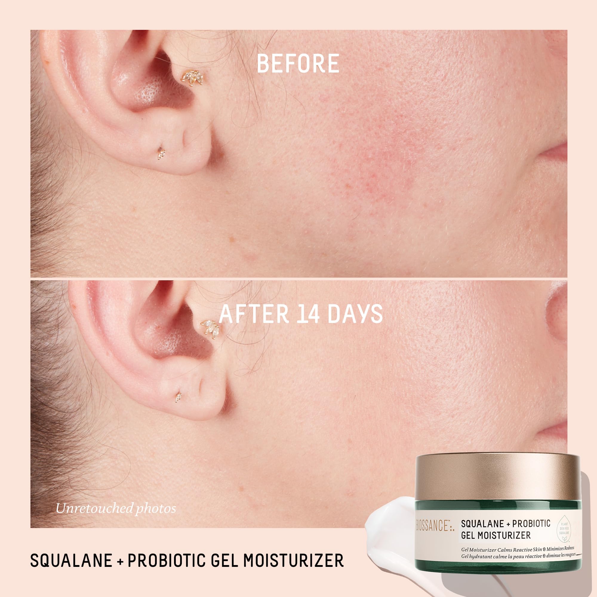 BIOSSANCE Squalane + Probiotic Balancing Face Gel Moisturizer | For Oily & Acne-Prone Skin