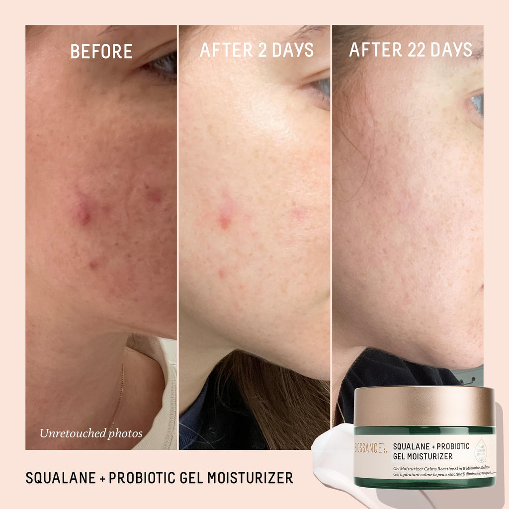 BIOSSANCE Squalane + Probiotic Balancing Face Gel Moisturizer | For Oily & Acne-Prone Skin