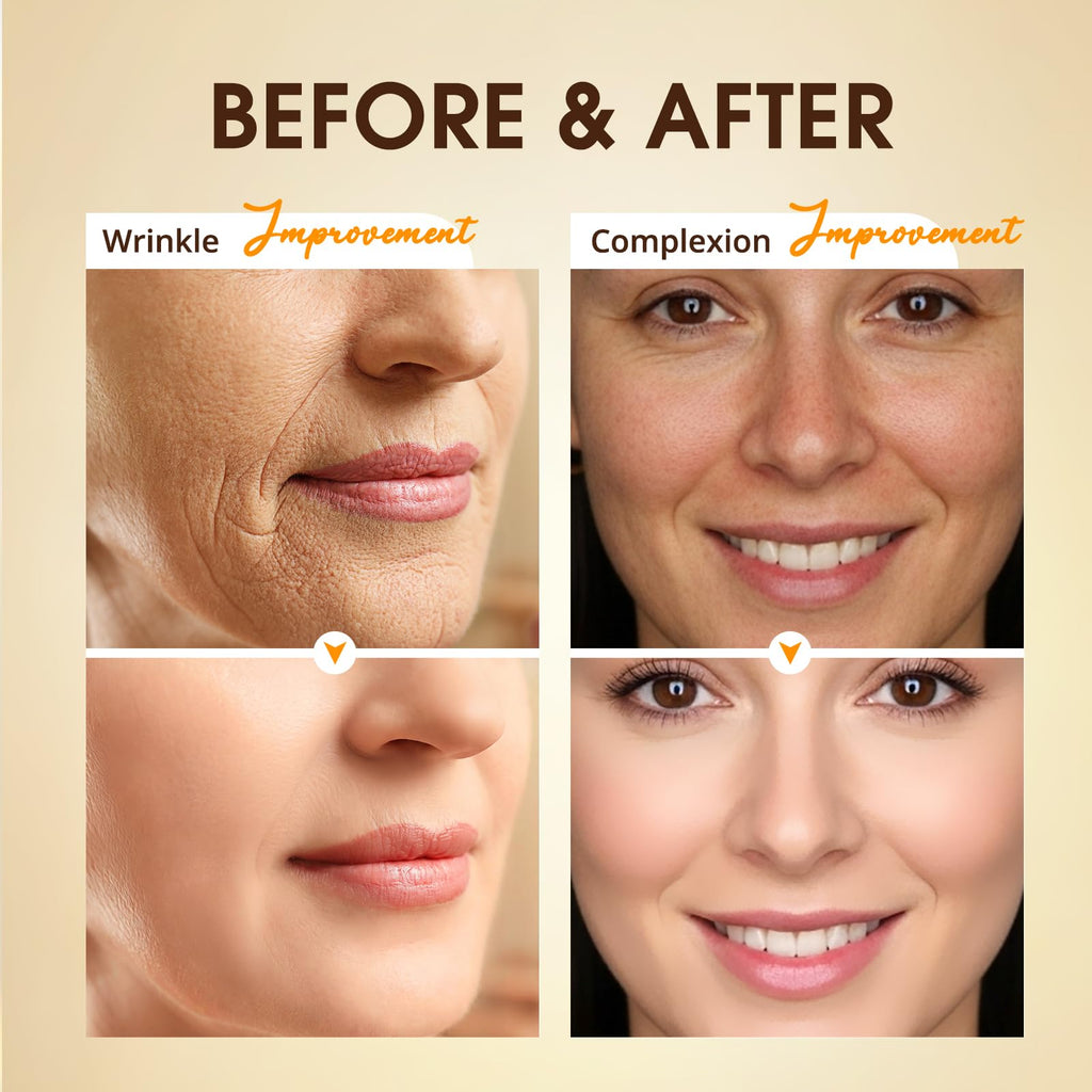 BIYSBER Retinol Collagen Serum for Face – Anti-Aging, Hydration & Firming (1.7 fl oz)