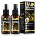 BLISSMATE 5% Minoxidil Hair Regrowth Spray for Men & Women | Thinning Hair & Beard Solution