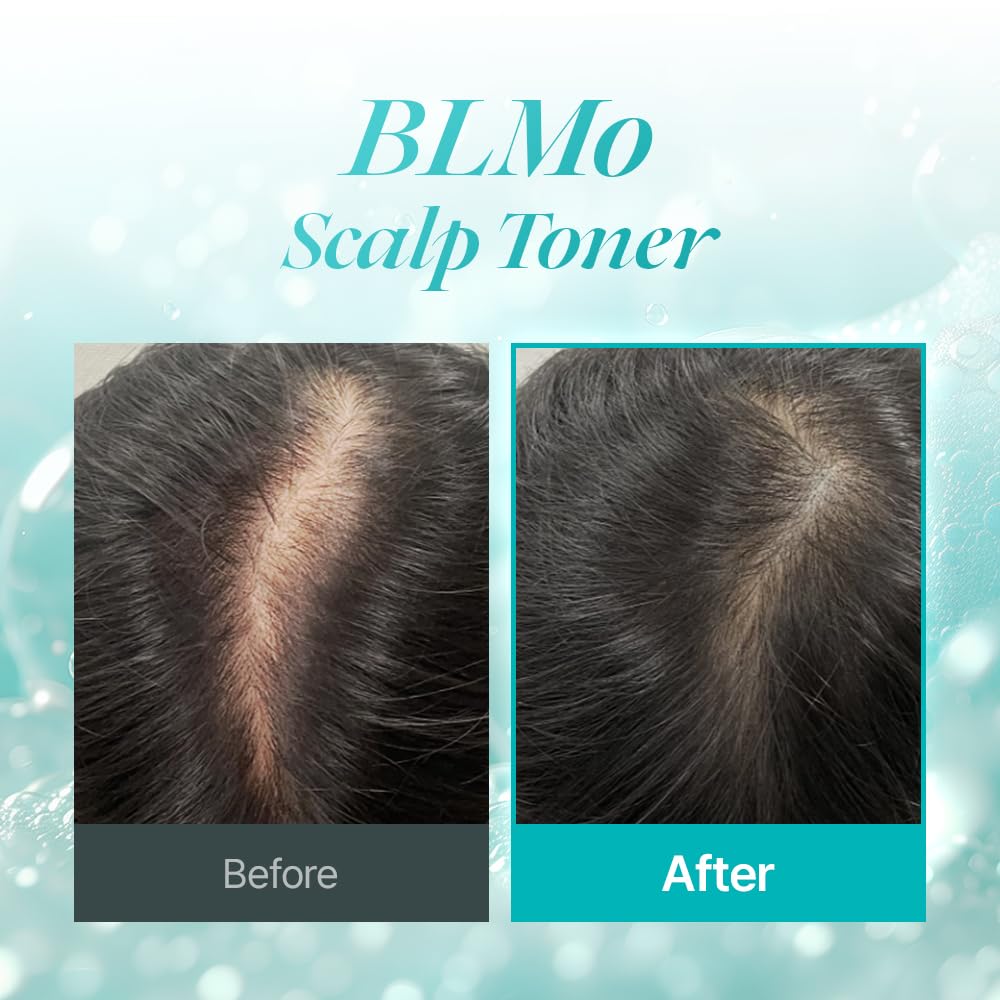 BLMo Scalp Toner – Clinically Studied Hair Thickening Serum for Thinning Hair