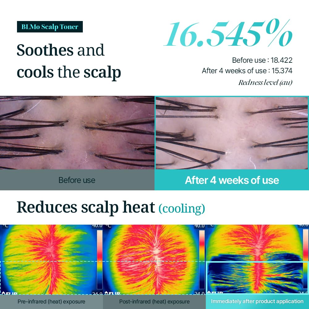 BLMo Scalp Toner – Clinically Studied Hair Thickening Serum for Thinning Hair