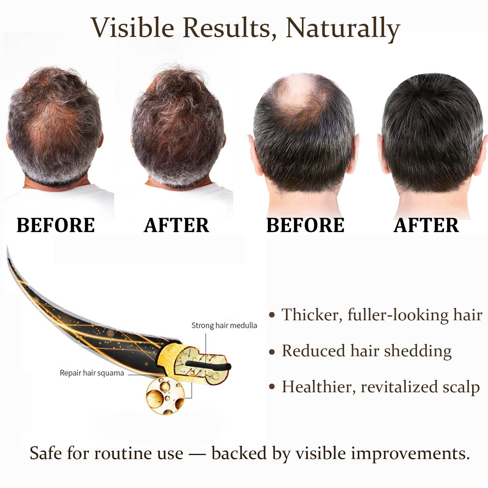 Boaccy Hair Regrowth System – Advanced Hair Growth Treatment with Ginseng, Eclipta Prostrata, Peppermint Oil & Ginger Root