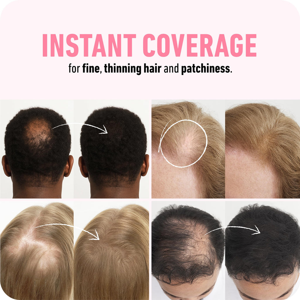 Boldify Hair Fibers (2 x 56g) – Instantly Fuller Hair, 14 Shades (Medium Brown)