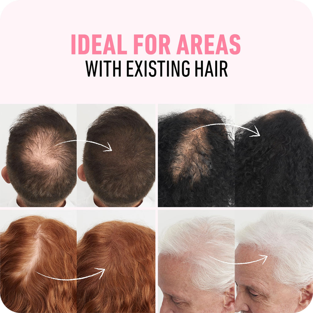 Boldify Hair Fibers (2 x 56g) – Instantly Fuller Hair, 14 Shades (Medium Brown)