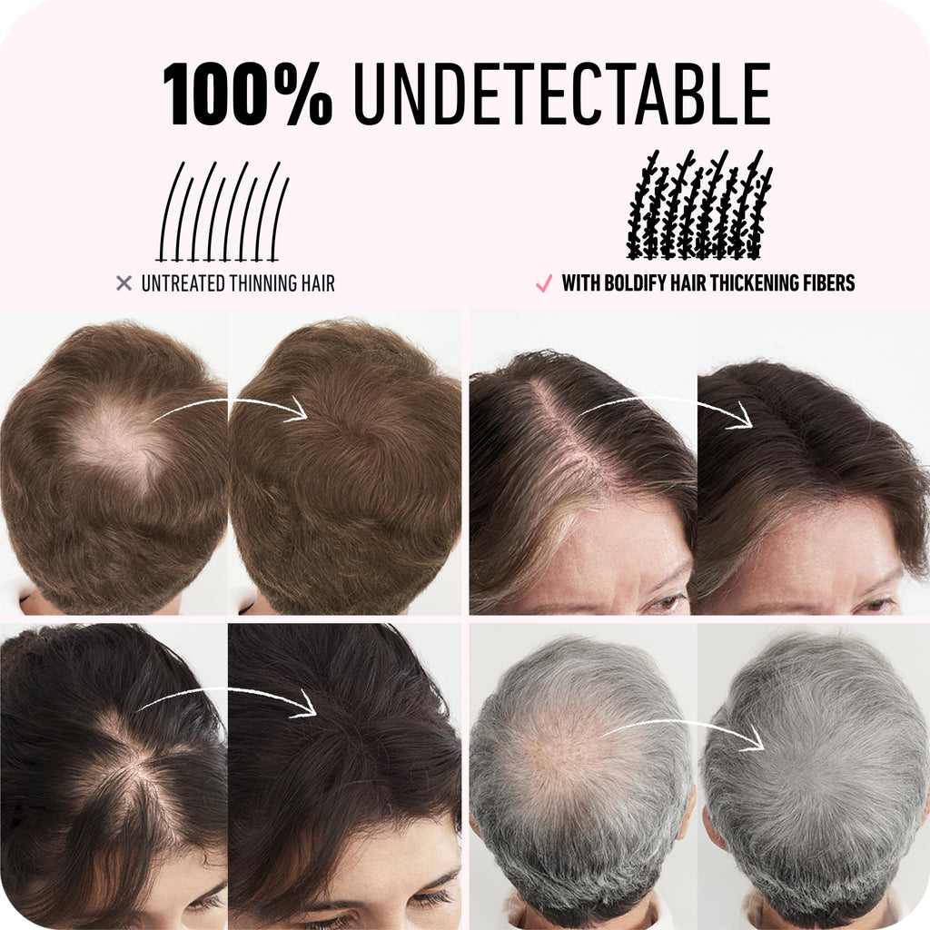 Boldify Hair Fibers (2 x 56g) – Instantly Fuller Hair, 14 Shades (Medium Brown)