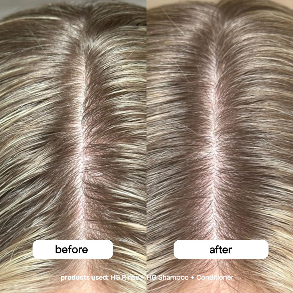 BondiBoost HG Clarifying Hair Rinse – Aloe-Based Detox for Scalp Balance