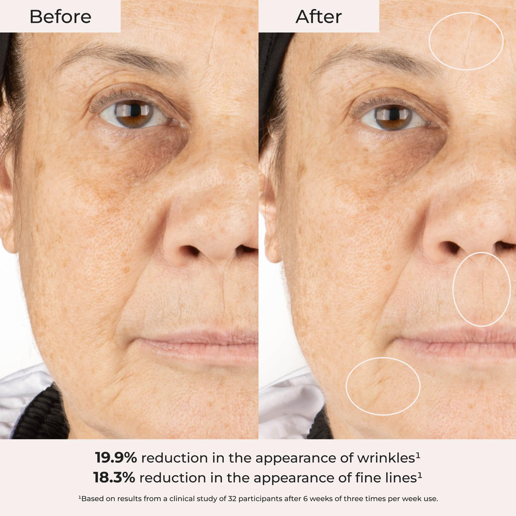 Borghese Overnight Resurfacing Mask with AHA & BHA – Exfoliating Night Mask
