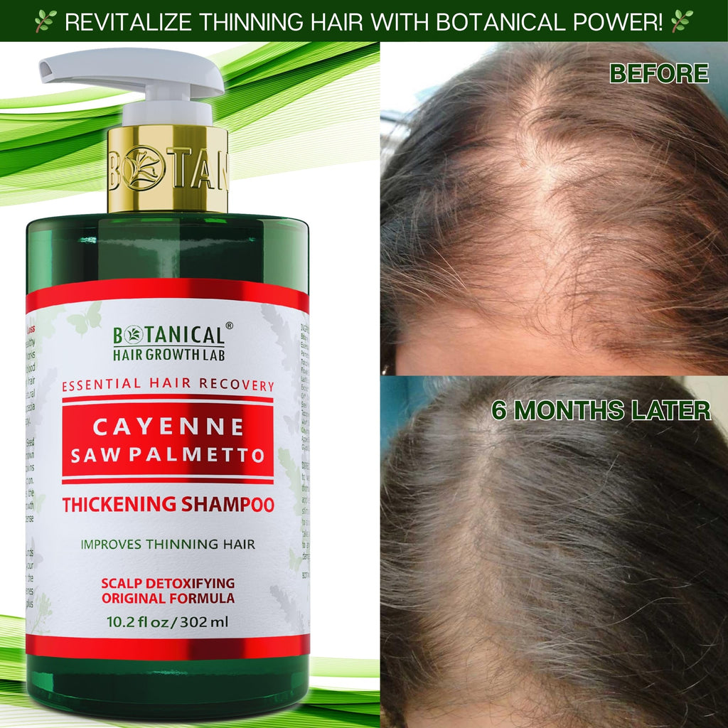 Botanical Cayenne Shampoo with Saw Palmetto – Thickening & Scalp-Stimulating | BOTANICAL HAIR GROWTH LAB 10.2 oz