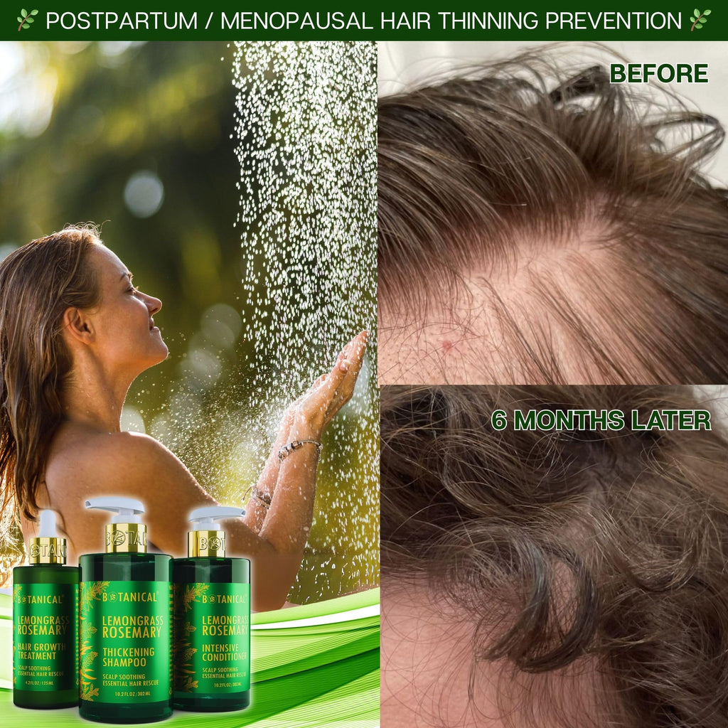 Botanical Hair Growth Lab Rosemary Shampoo with Saw Palmetto – Thinning Hair Support (10.2 oz)