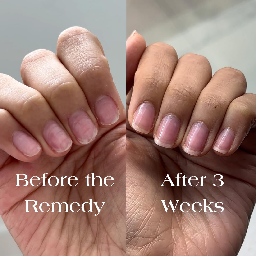 Botanist Nails The Remedy | Nail Strengthening Polish for Damaged Nails – Rose