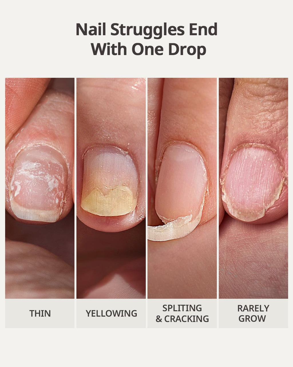 BTARTBOXNAILS Naillush Nail Strengthener & Growth – Repair & Strengthen Nails (15ml)