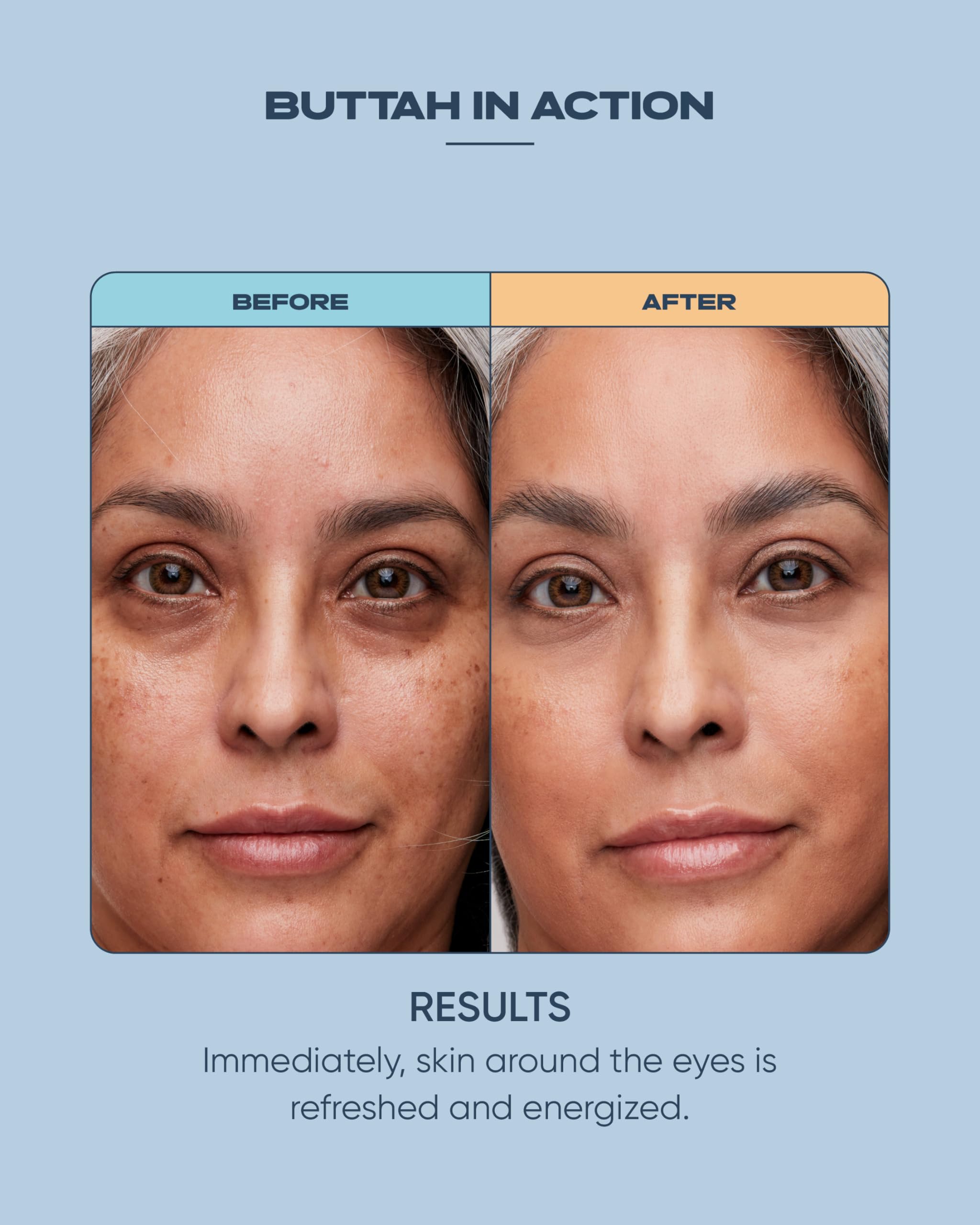 Buttah Skin Awakening Eye Cream – Dark Circles & Puffiness | Hydrating Under-Eye Care