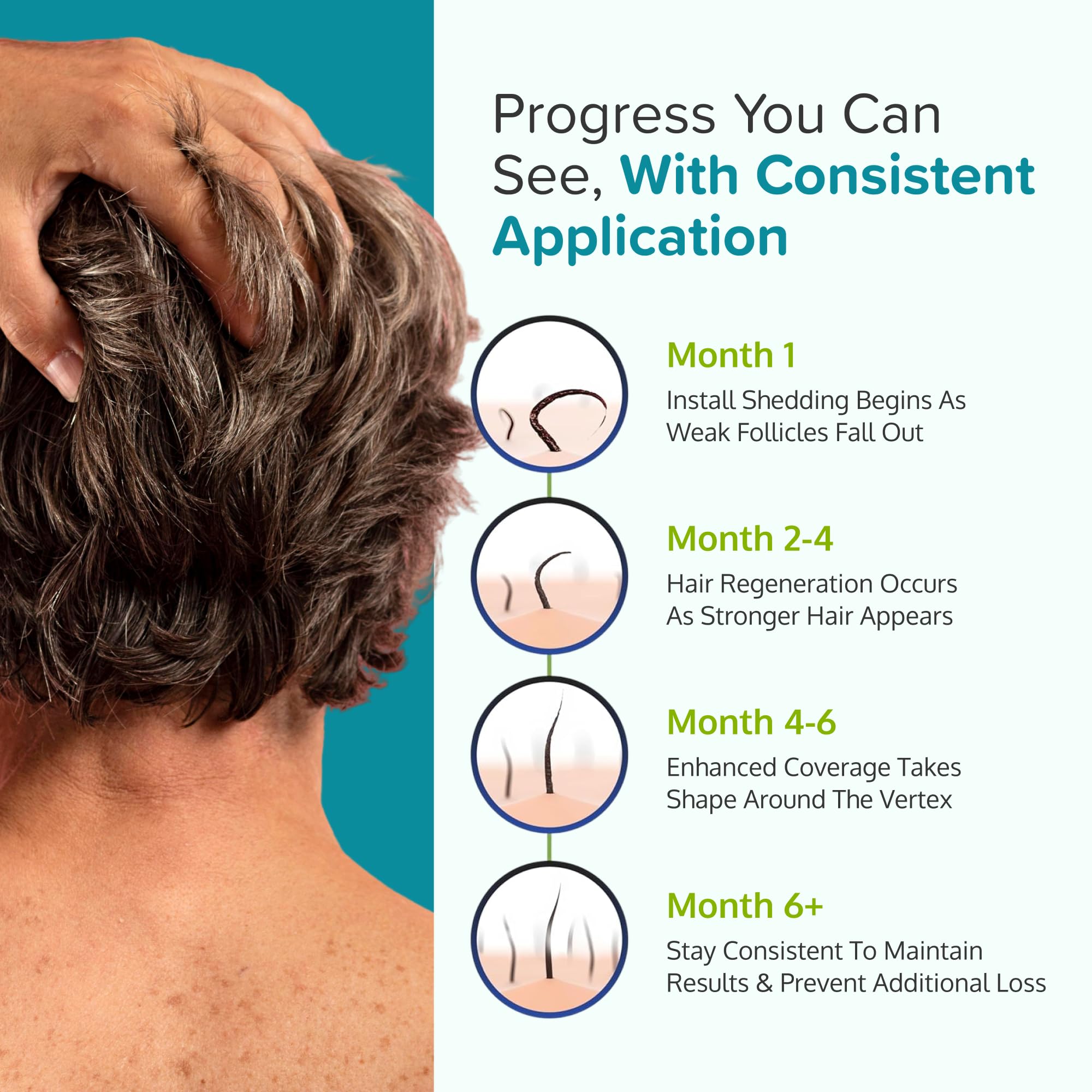 C'rcle Minoxidil 5% Foam for Men – Unscented, 3-Month Supply | Vertex Hair Loss & Thinning Support