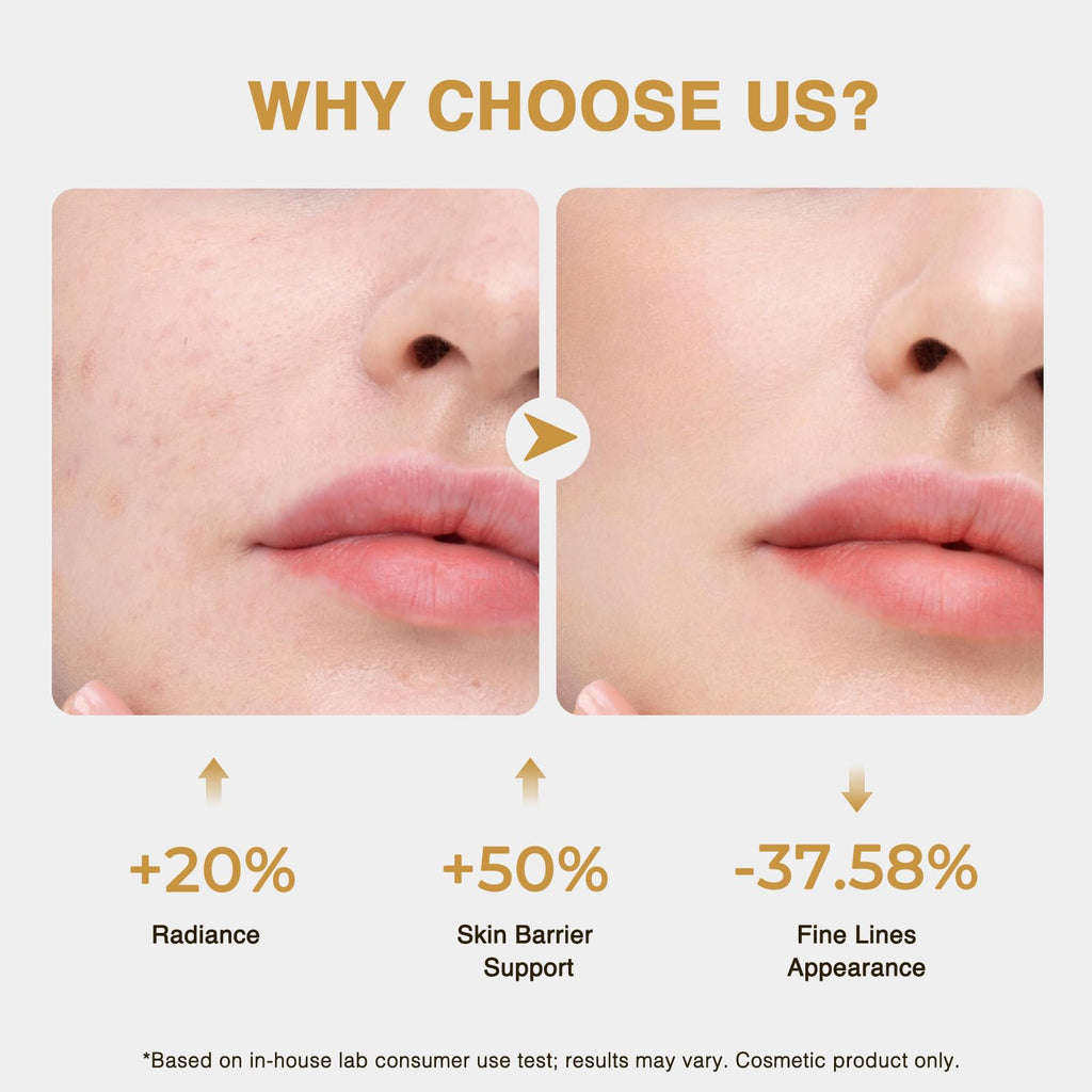 CA CAREL Face Serum – Collagen, Peptides & Niacinamide for Hydration, Brightening & Firming