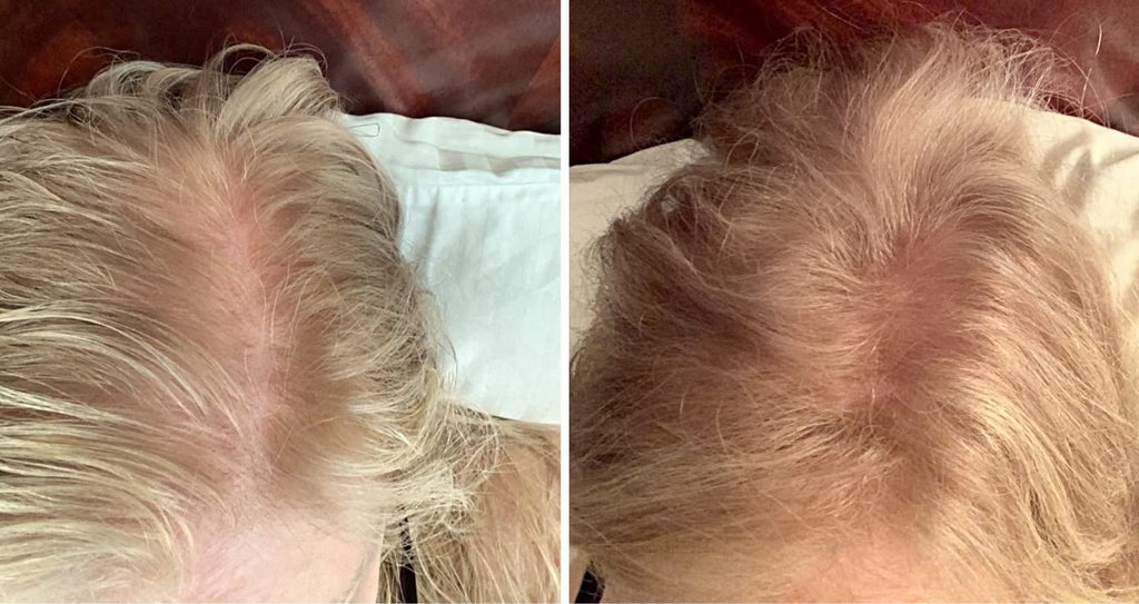 Caboki Hair Loss Concealer – All-Natural Fibers for Fuller-Looking Hair (30g, Golden Blonde)
