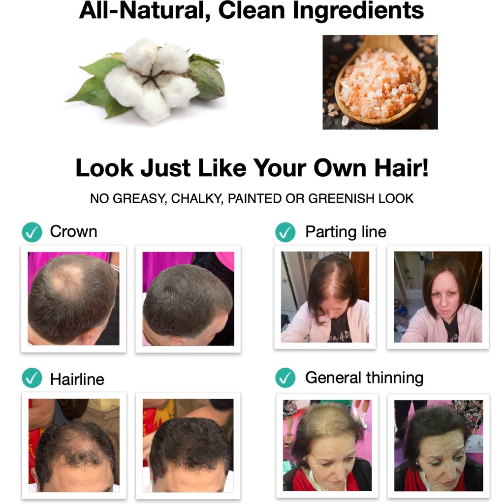 Caboki Hair Loss Concealer – All-Natural Fibers for Fuller-Looking Hair (30g, Golden Blonde)