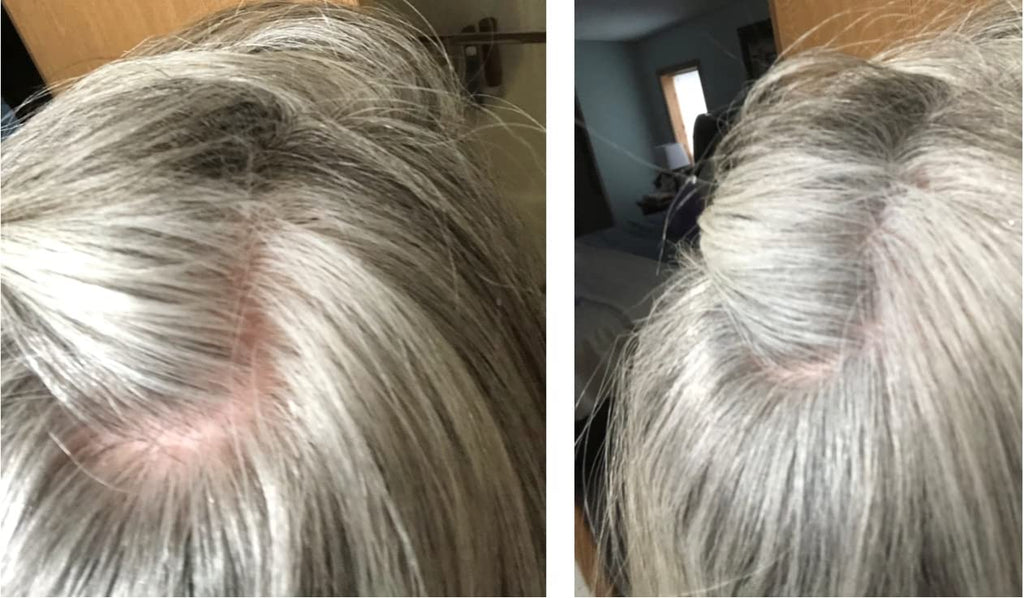 Caboki Hair Loss Concealer — All-Natural Fibers for Instant Fuller Hair (30g, 90-Day Supply, Gray)