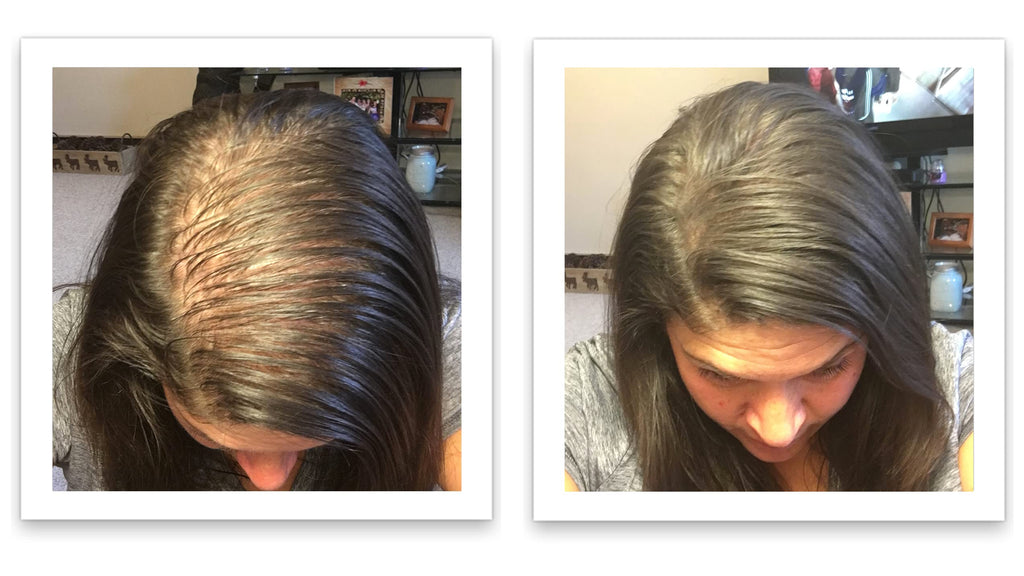 Caboki Hair Loss Concealer – 90-Day Supply, Dark Brown | Instantly Fuller-Looking Coverage