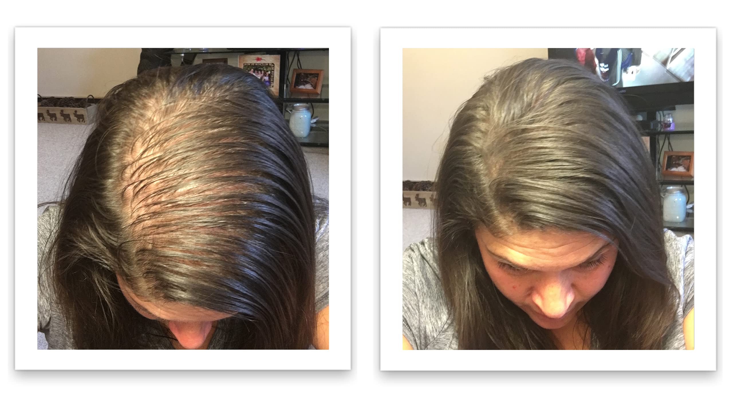 Caboki Hair Loss Concealer – 90-Day Supply, Dark Brown | Instantly Fuller-Looking Coverage