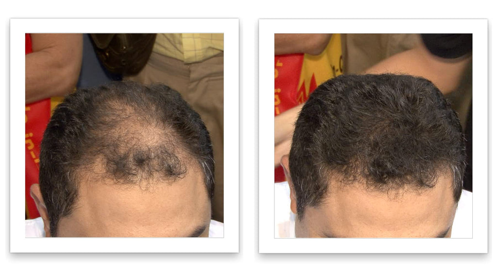 Caboki Hair Loss Concealer – 90-Day Supply, Dark Brown | Instantly Fuller-Looking Coverage
