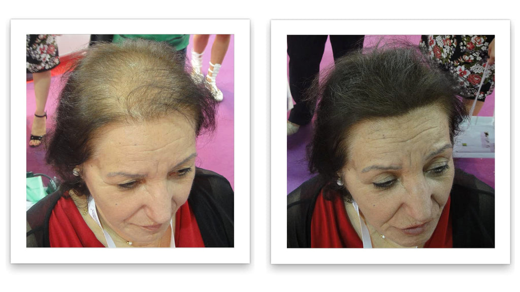 Caboki Hair Loss Concealer – 90-Day Supply, Dark Brown | Instantly Fuller-Looking Coverage