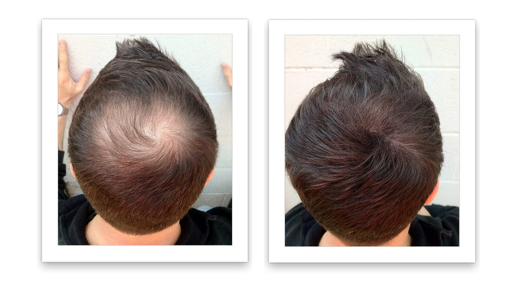 Caboki Hair Loss Concealer – 90-Day Supply, Dark Brown | Instantly Fuller-Looking Coverage
