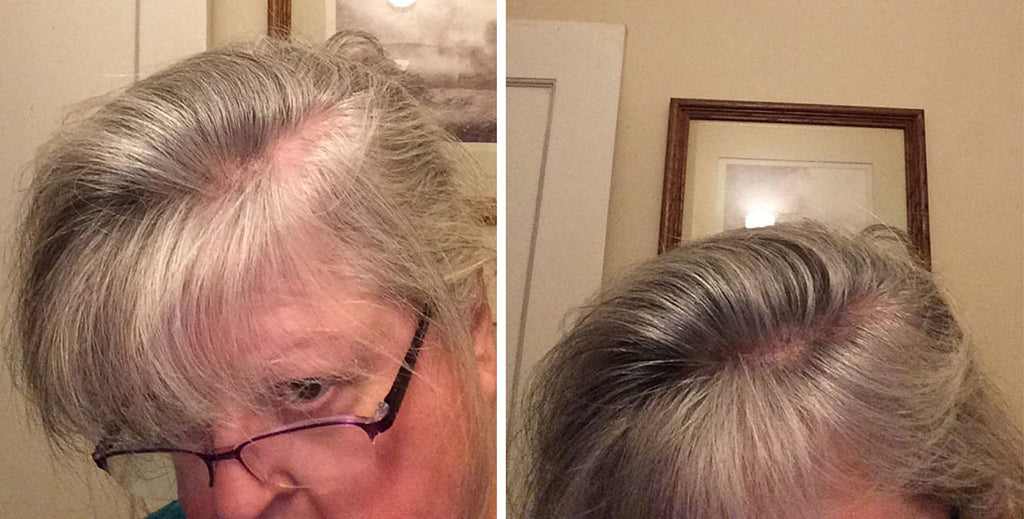 Caboki Hair Loss Concealer — All-Natural Fibers for Instant Fuller Hair (30g, 90-Day Supply) Salt & Pepper - Light