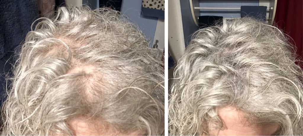 Caboki Hair Loss Concealer — All-Natural Fibers for Instant Fuller Hair (30g, 90-Day Supply, Gray)