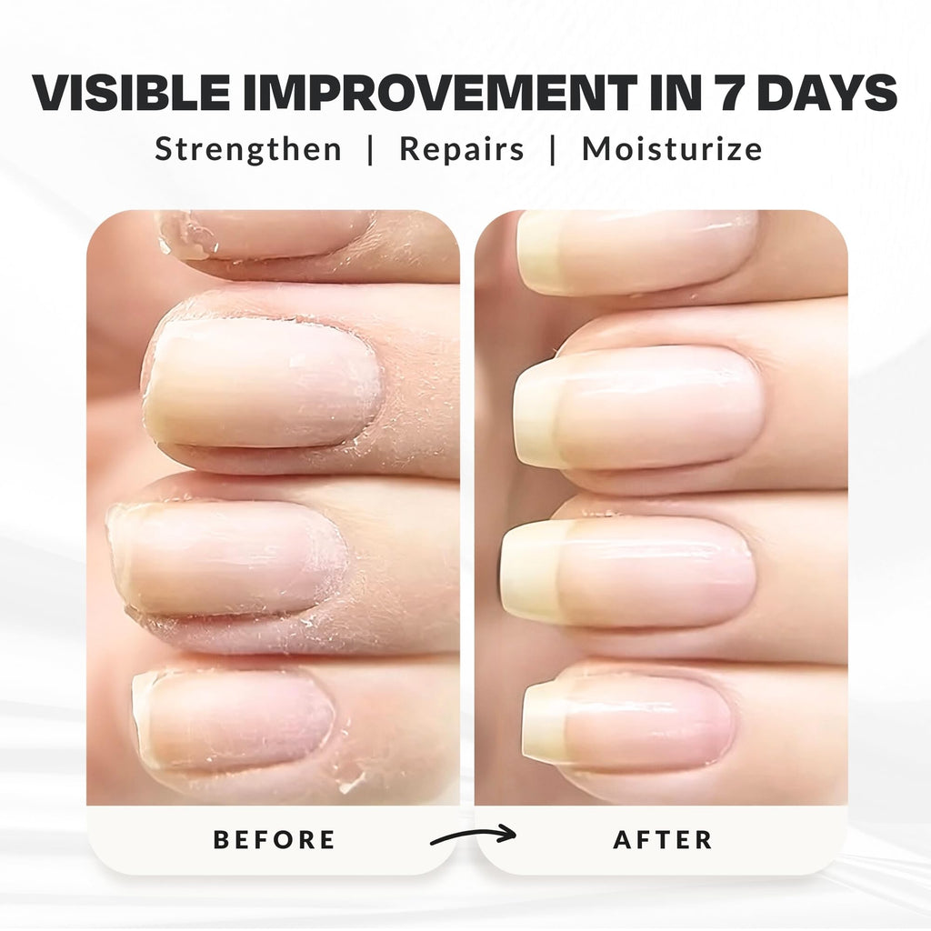 CAKE Nail Power Boost: Strengthener with Keratin, Biotin & Vitamin E | Base Coat & Top Coat